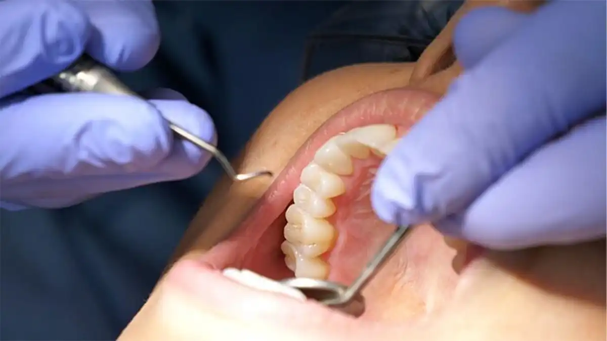 What's The Actual Difference Between Laser and Tray Teeth Whitening—And Why Should You Give a Floss High-Wycombe?